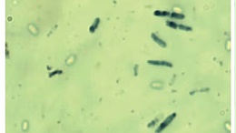 胶冻样芽孢杆菌在生物菌肥中具有重量级的存在感！